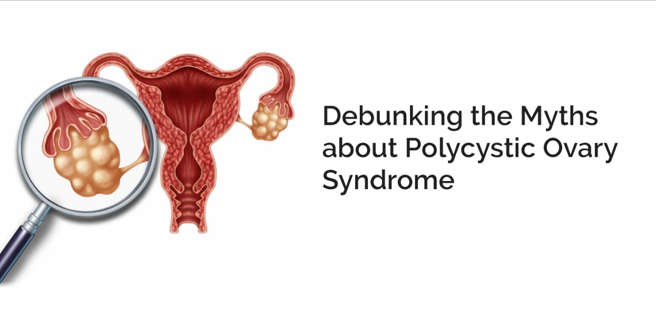 Debunking the Myths about Polycystic Ovary Syndrome