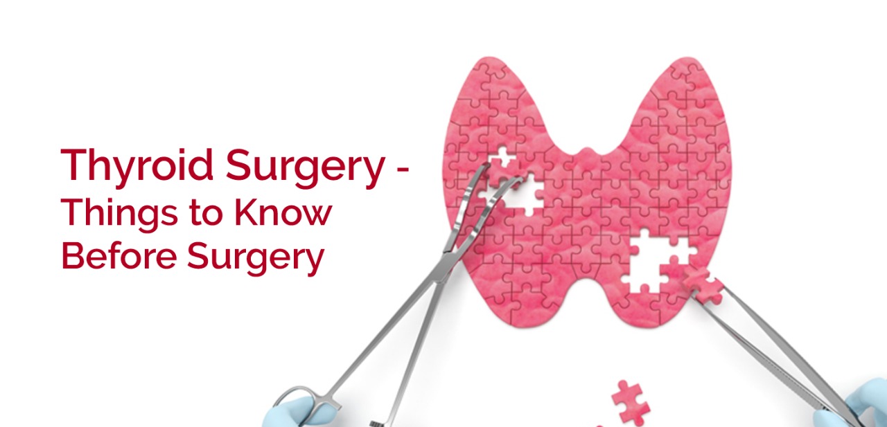 Thyroid Surgery - Things to Know Before Surgery