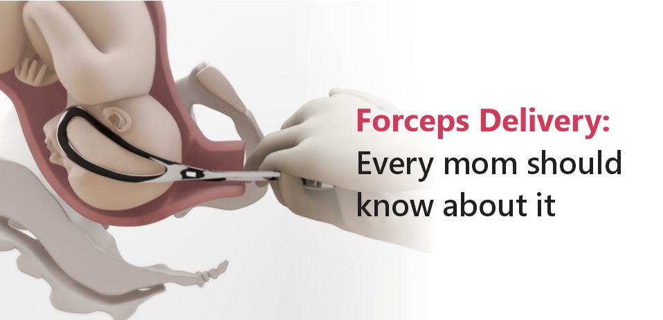 Forceps Delivery: Every Mom Should Know About It