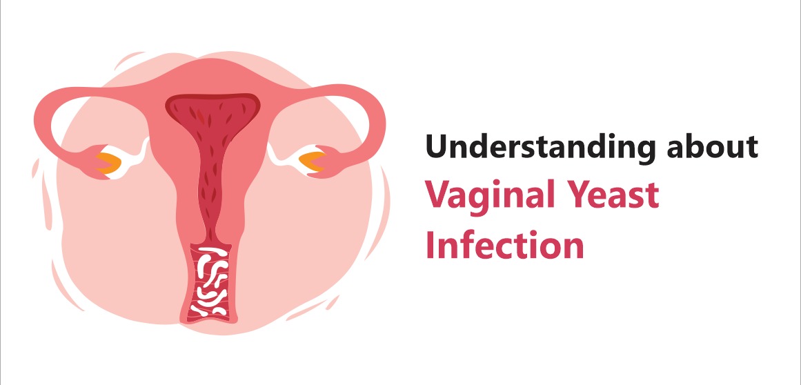 Understanding about Vaginal Yeast Infection